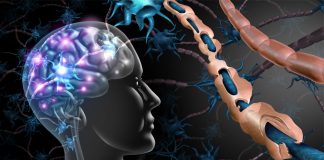 Scleroza multipla: simptome, cauze si tratamente