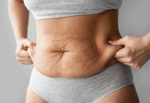 Mituri despre celulita si ce poti face pentru a o trata