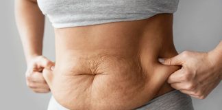 Mituri despre celulita si ce poti face pentru a o trata