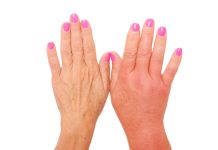 Remedii la domiciliu pentru retentia de lichide