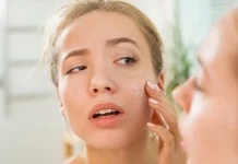 10 remedii pentru a vindeca pielea uscata din jurul nasului si sfaturi de prevenire